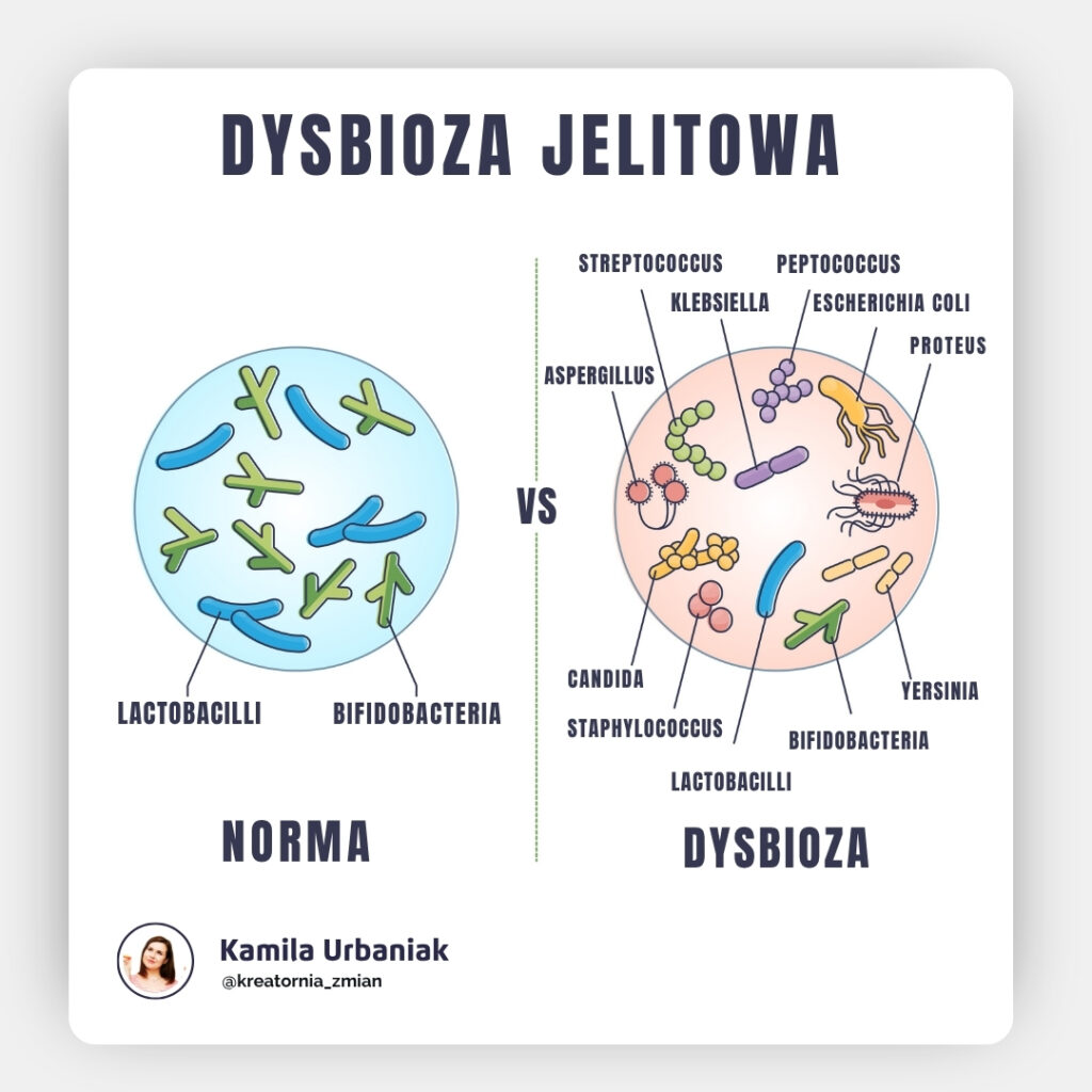 DYSBIOZA JELIT 